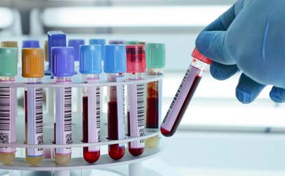 Foto de pruebas de laboratorio. Eduardo Behrentz