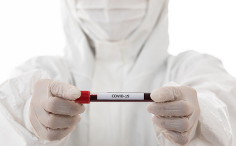 Foto de una muestra de sangre con la etiqueta COVID-19
